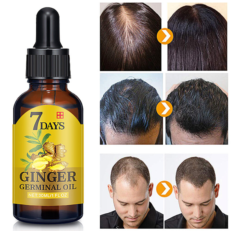 Продукт для роста волос растений для мужчин и женщин, 7-дневное быстрое прорастающее масло, лечение выпадения волос, стимулирование роста во...