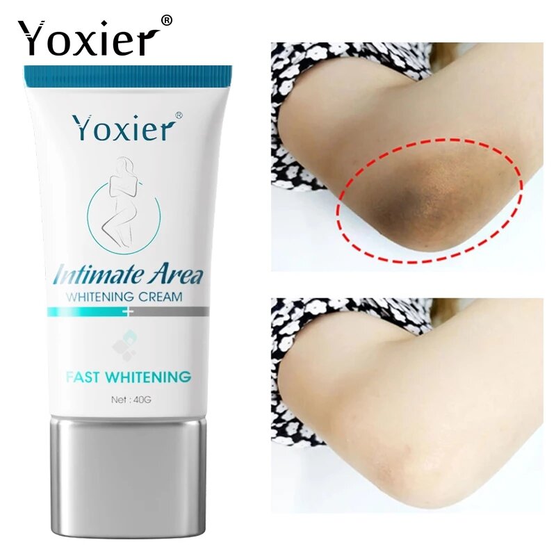 Yoxier Area intima crema sbiancante schiarire riparazione ascella gomito glutei idratante nutriente Nicotinamide cura della pelle del corpo 40g