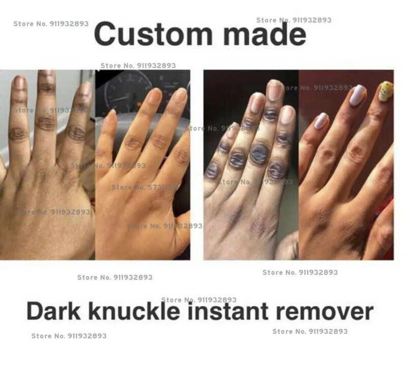 Creme dark knuckles, creme muito forte, removedor de manchas escuras, resultados rápidos