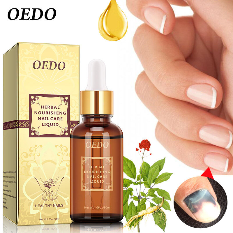 OEDO Herbal Treatment ลบเชื้อราเล็บมือและเท้า Whitening Nourishing Nail Care Solution Unisex สปาเท้า
