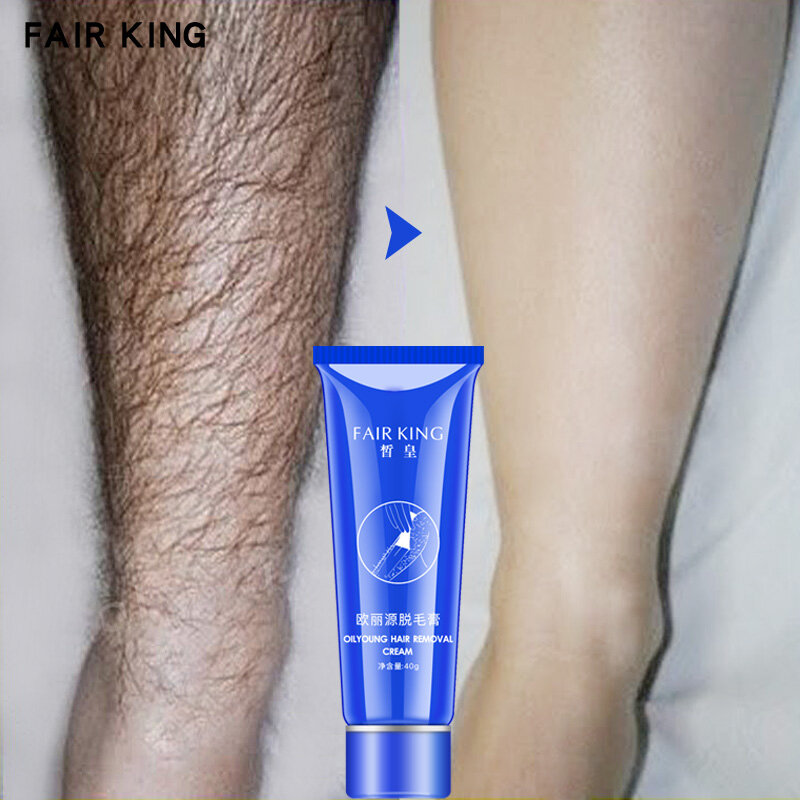 KING FAIR – crème dépilatoire à base de plantes pour hommes et femmes, pour éliminer les poils, sans douleur, aisselles, jambes, soins du corps, rasage