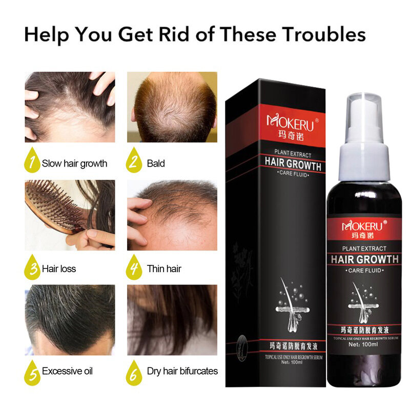 Mokeru-aceite de ricino de plantas herbales para hombres, aceite de crecimiento rápido del cabello, pérdida de cabello tratamiento Anti, 1 unidad