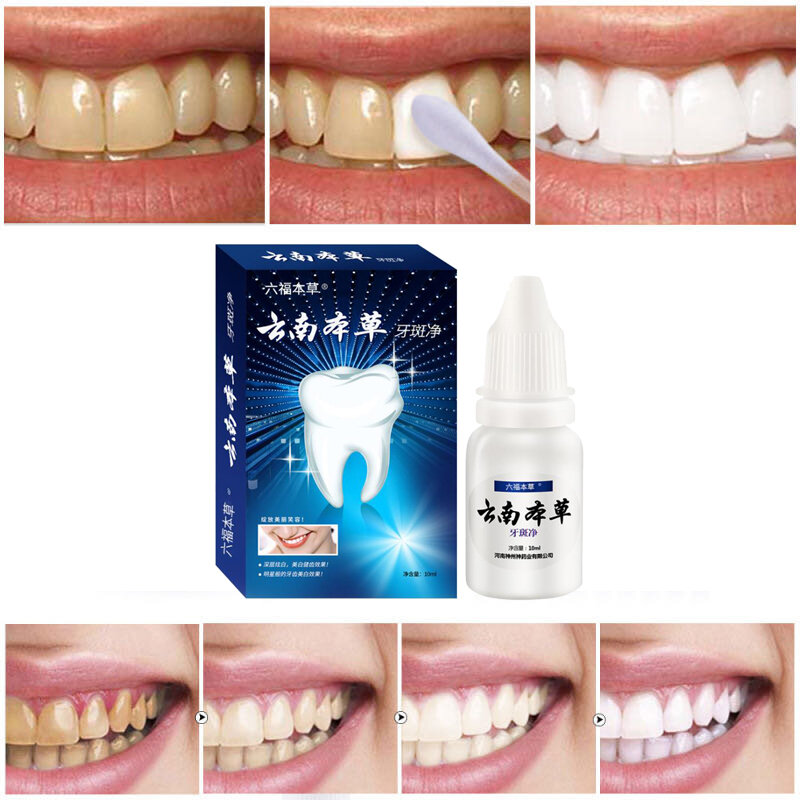 歯のホワイトニング歯粉末50グラム、削除煙汚れ、コーヒー、茶シミ、さっぱり口臭、口腔衛生、歯科ケア