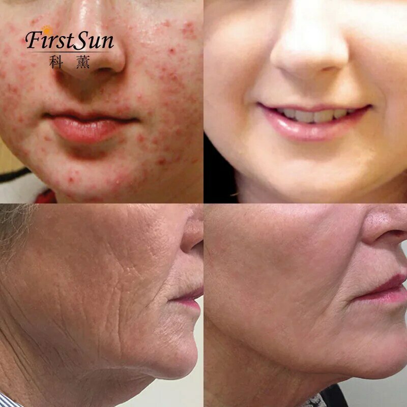 Witamina C serum z kwasem hialuronowym nadaje się do starzenia się Anit/Wrinke pielęgnacja twarzy nawilżający i rozjaśniający odcień skóry Serum do twarzy