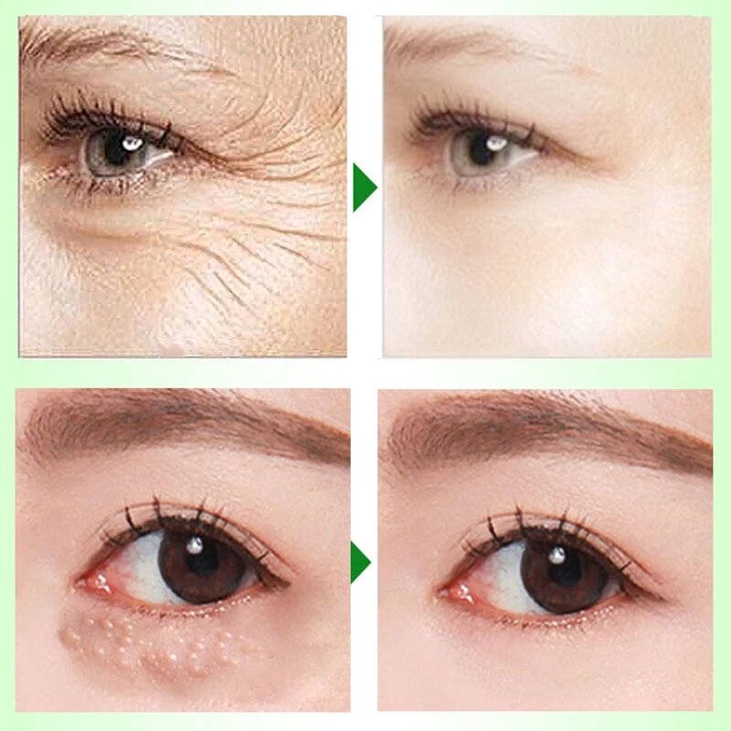 Crema per gli occhi istantanea retinolo rassodante Anti gonfiore invecchiamento rughe rimuovi occhiaie idratante cura della pelle cosmetici coreani 20G