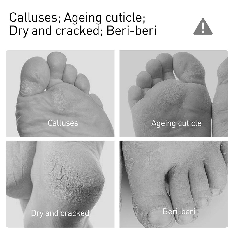 Спрей AuQuest для удаления мозолей и омертвевшей кожи ног, восстанавливающий крем для пятки с трещинами, против трещин, сухости рук, уход за ног...