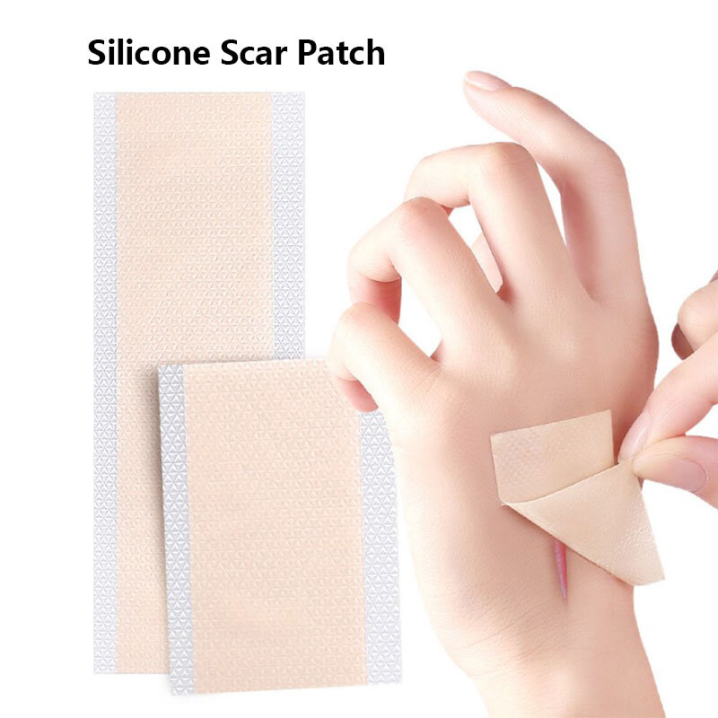 Parche de silicona para la eliminación de cicatrices, parche de terapia para el tratamiento de la cicatriz del acné, reparación de la piel