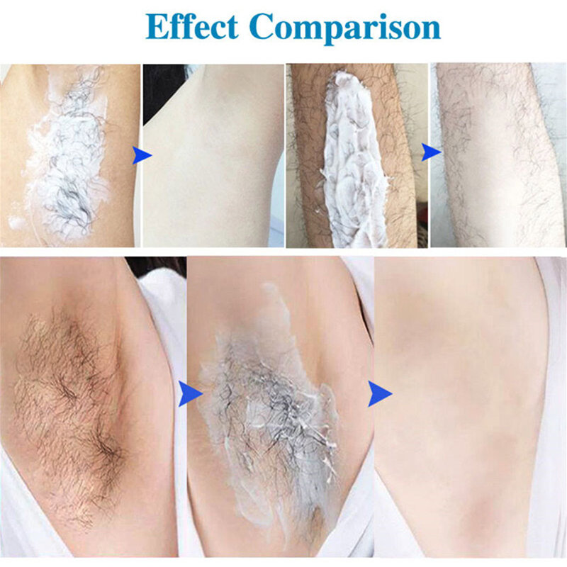 KING FAIR – crème dépilatoire à base de plantes pour hommes et femmes, pour éliminer les poils, sans douleur, aisselles, jambes, soins du corps, rasage