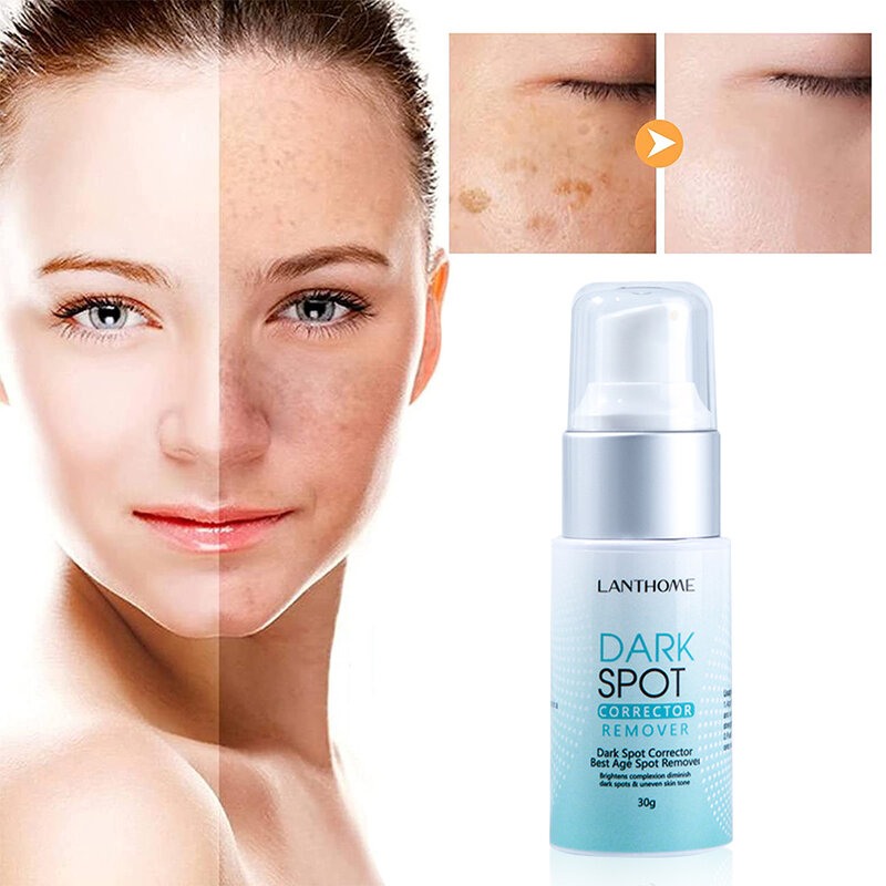Per LANTHOME Dark Spot Remover correttore età Spot rimozione lentiggine emulsione sbiancante idratante riparazione anti-età cura della pelle