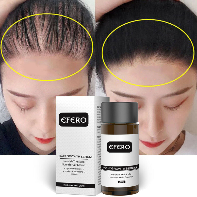 20ml produkty stymulujące porost włosów zapobieganie utrata włosów olej szybkie odrastanie włosów esencja przywrócić korzenie włosów Hairline gęsta pielęgnacja włosów mężczyzna kobieta