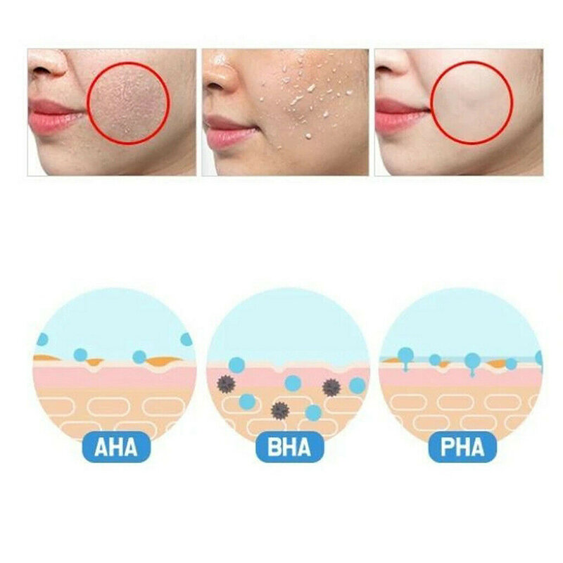 Gel Peeling viso esfoliante per pori dell'acne da donna delicato 100g idratante HJL2019