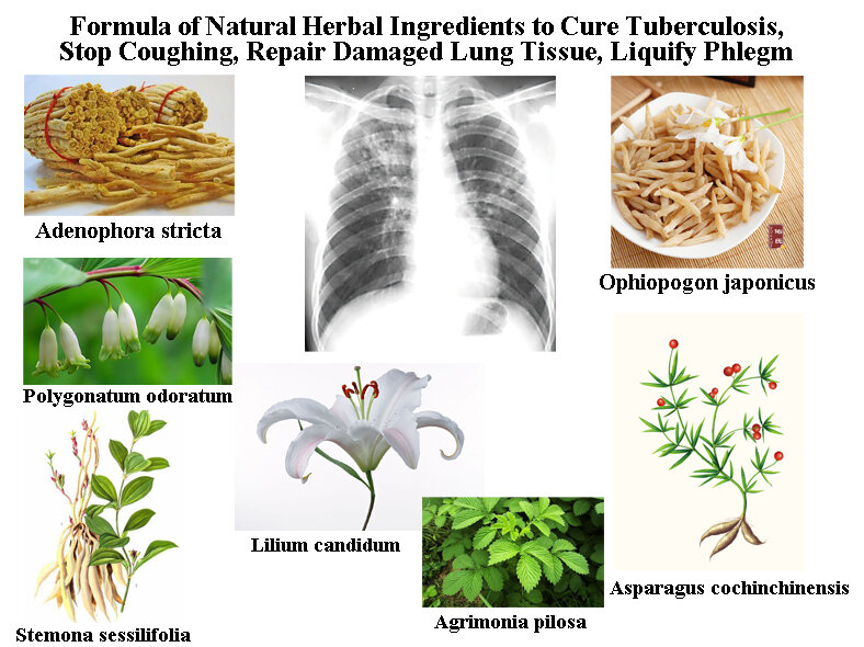 Fórmula de ingredientes herbales naturales para curar la vagina, dejar de toser, reparar el tejido de los pulmones dañado, liquidar la flema,