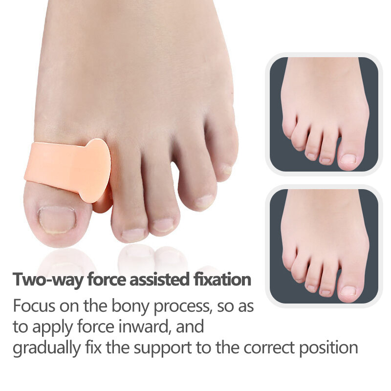 Separador de dedos de los pies de silicona, aparato ortopédico superpuesto para el pulgar, Corrector de valgo, herramientas para el cuidado de los pies, 2 uds.