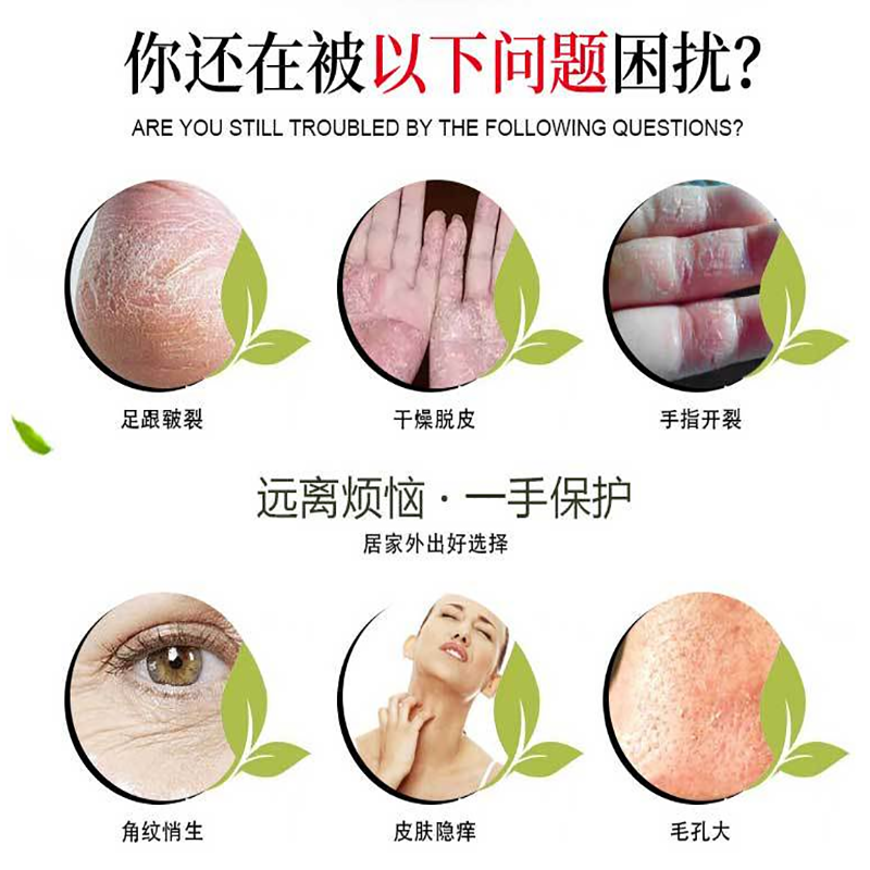 Unguento pelle Vegetale a base di erbe essenza la cura della pelle anti-rughe della pelle crema anti-cracking adatto per il freddo anti-cracking crema