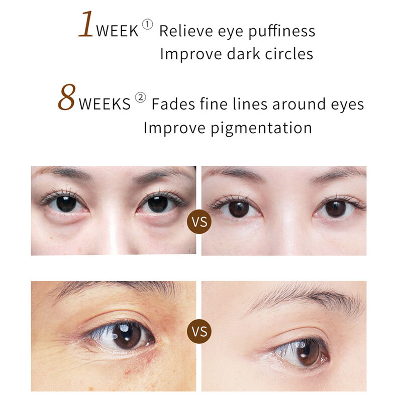 Crema de ojos y serum para ojos, mejora las arrugas de los ojos y Reduce las ojeras, bolsas de ojos, crema antienvejecimiento para el cuidado de los ojos