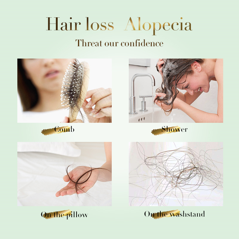 Aceite para el crecimiento del cabello para mujeres, suero de extracto de plantas naturales, esencia antipérdida de cabello, tratamientos del cuero cabelludo, producto efectivo para el cuidado del cabello