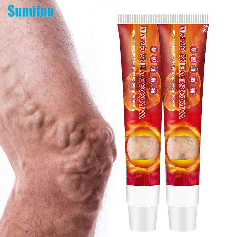 Sumifun 2020 New Varicose Veins Treatment Cream 100% Original Vasculitis Phlebitis Spider Pain Relief Ointment Medical Plaster