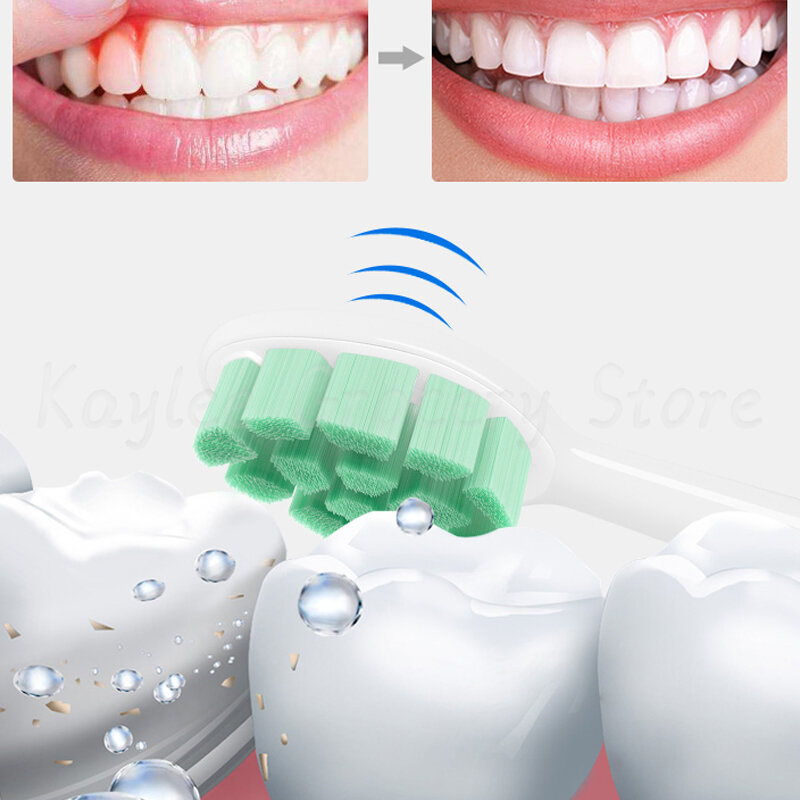 Xiaomi Mijia-cabezales de cepillo de dientes eléctrico T300/T500, Ultra sónico, 3D, para blanqueamiento Oral, repuesto de alta densidad