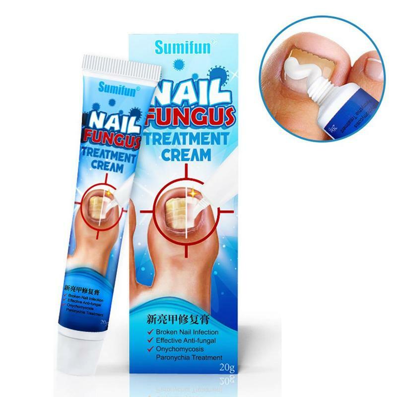 Best Fungus Nail Treatment Cream Onychomycosis Paronychia Fungal Infection Naturally Fights And Nail Bacteria Fungus Anti