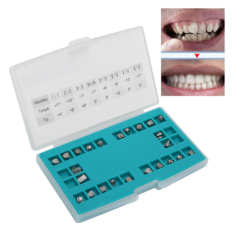 24 pçs pequeno mini suporte ortodôntico dental self‑ligando de metal dos cuidados orais suportes mbt3 gancho com caixa de armazenamento cinta ferramenta