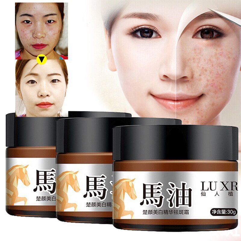 Hot Suction Spot Cream Face Care Whitening Remove Freckle Dark Horse Oil Cream strong Whitening Freckle Creams Melasma Removal
