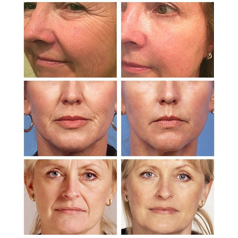 20ml Retinol Gesicht Creme Anti-Aging-Straffende Hebe Falten Feine Linien Bleaching Creme Ageless Feuchtigkeitsspendende Gesichts Hautpflege