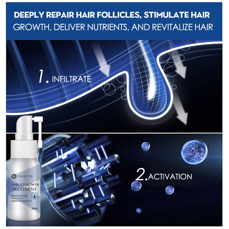 مكافحة فقدان الشعر رذاذ فعالية نمو الشعر علاج جوهر النفط للرجال والنساء مستخلصات طبيعية منتجات إعادة نمو الشعر السائل