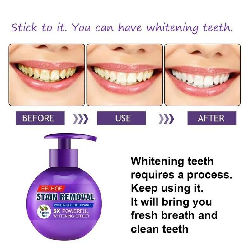 Intensive Stain Remover Whitening Toothpaste 220g Fruit Baking Gums Toothpaste Toothpaste Teeth Bleeding Anti Care Soda Fla R5H1