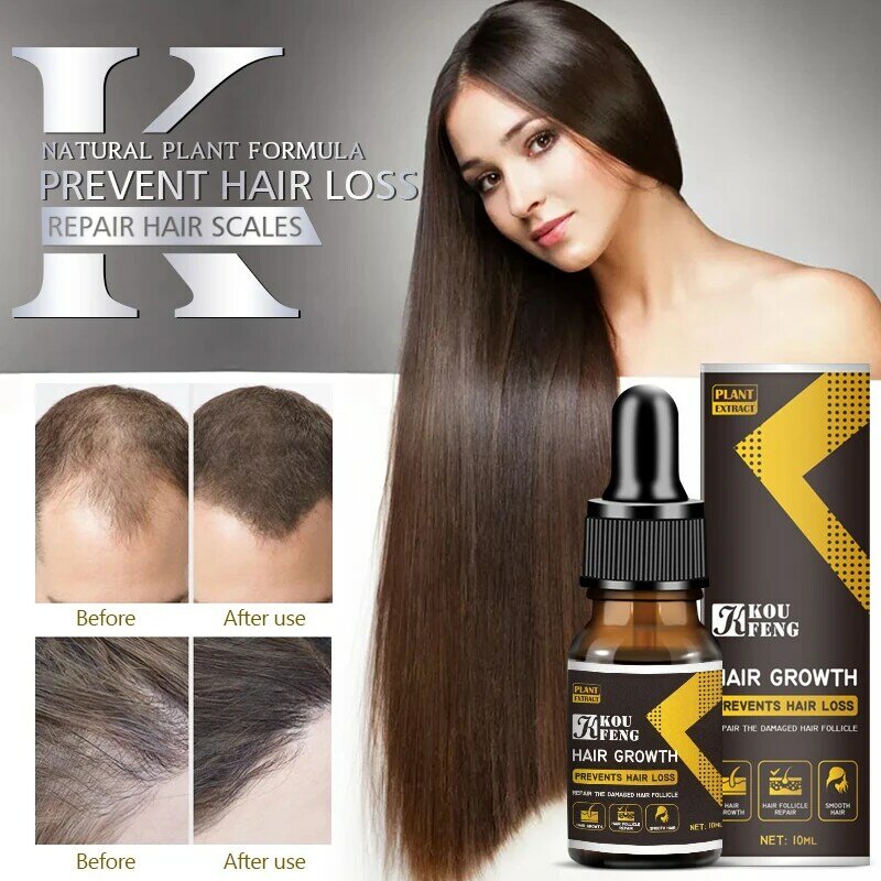 Esencia anticaída de cabello, esencia para mejorar el crecimiento del cabello, tratamiento y regeneración del cuero cabelludo, engrosamiento y brillo