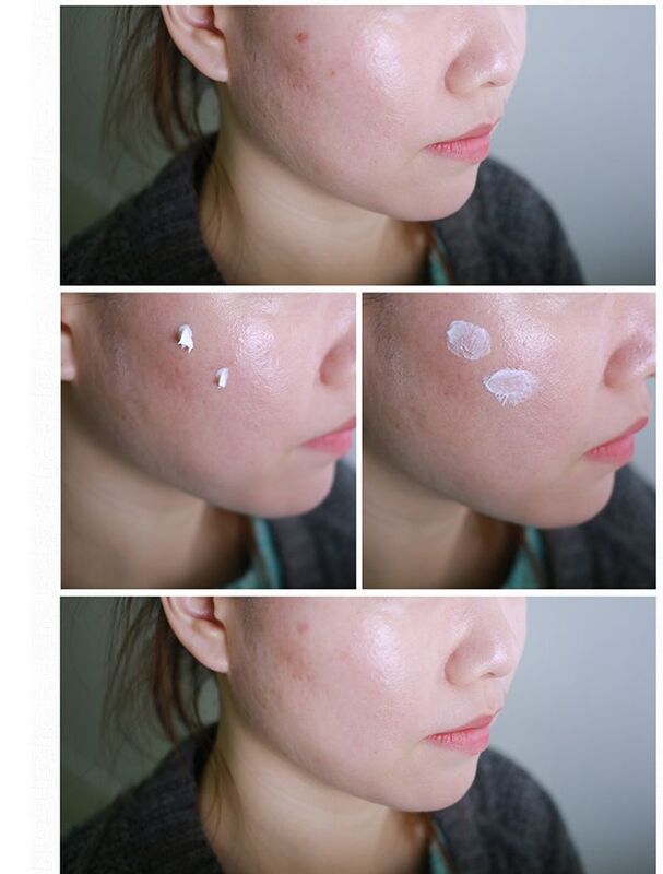 Cosrx Centella Crema para manchas 30ml aliviar problemas de la piel profundamente hidratante cuidado tratamiento quitar acné Anti cicatriz Corea cosméticos