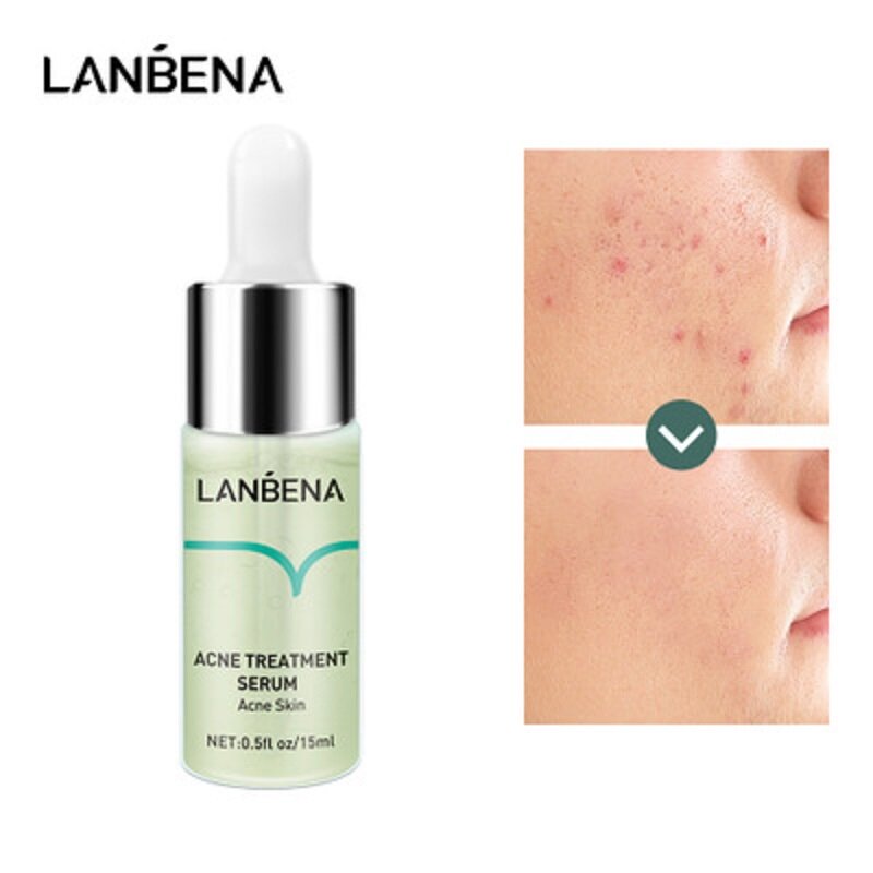 LANBENA-suero de ácido salicílico para el acné, esencia facial antiacné, reparador de granos, cicatrices, manchas oscuras, blanqueamiento de la piel, reducción de poros, Control de aceite