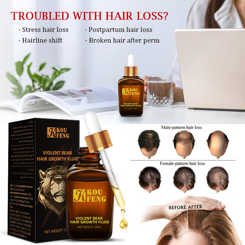 Snelle Haargroei Essentie Natuurlijke Kruiden Gezondheid Behandeling Haaruitval Maakt Haar Groei Langer En Dikker Haarverzorging Producten 30ml