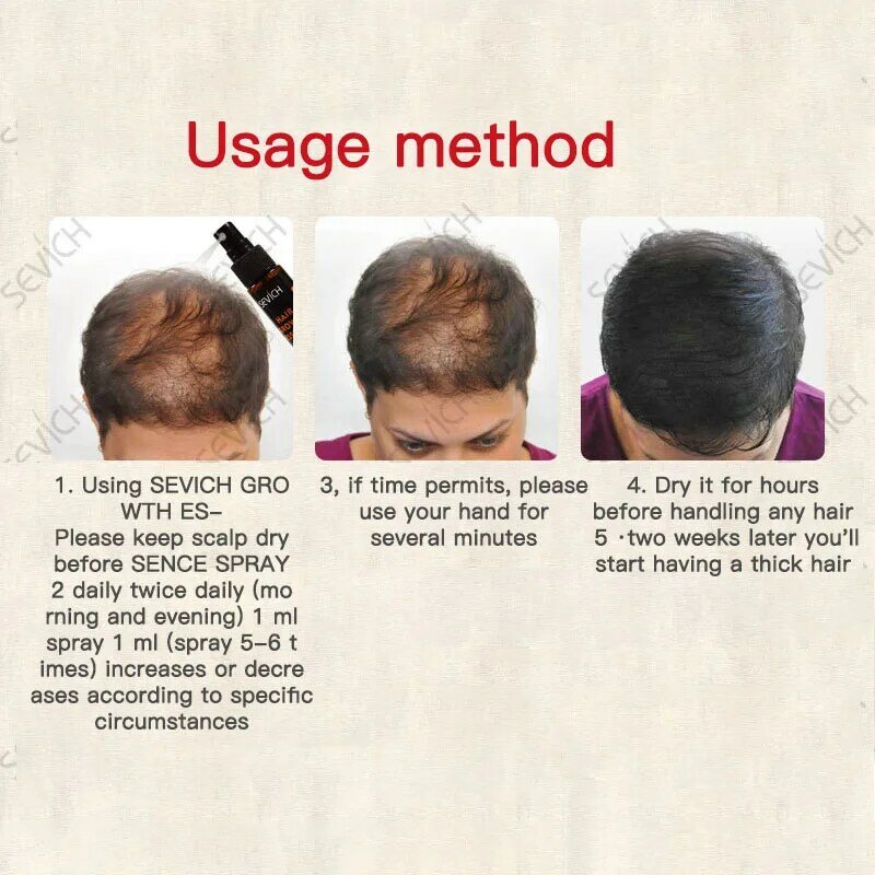 1 Buah Semprotan Pertumbuhan Rambut Cepat Ekstrak Jahe Mencegah Rambut Rontok Membantu Pertumbuhan Rambut Perawatan Rambut Alami Tanpa Efek Samping
