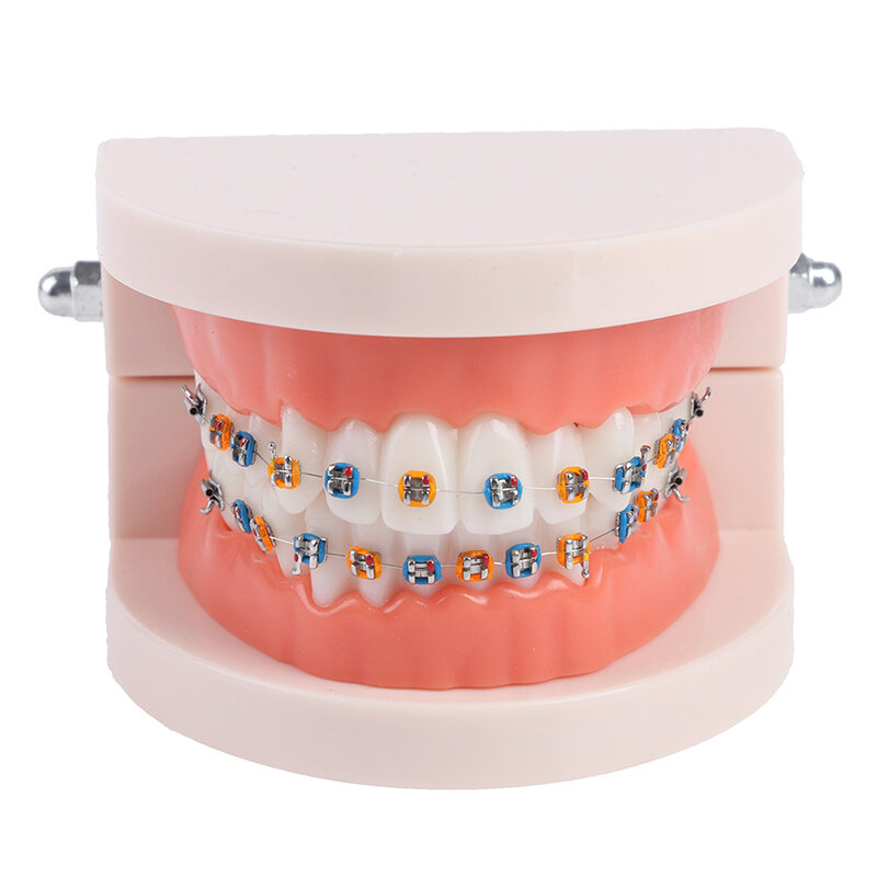 Tandheelkundige ortodontische tanden modelo met metalen beugels bretels escola onderwijs apparatuur