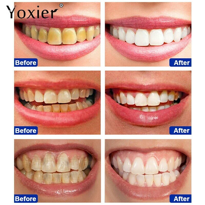 Dentes clareamento caneta limpeza profunda remove manchas ilumina os dentes amarelos lixívia a respiração fresca nutre cuidados dentários não irritantes