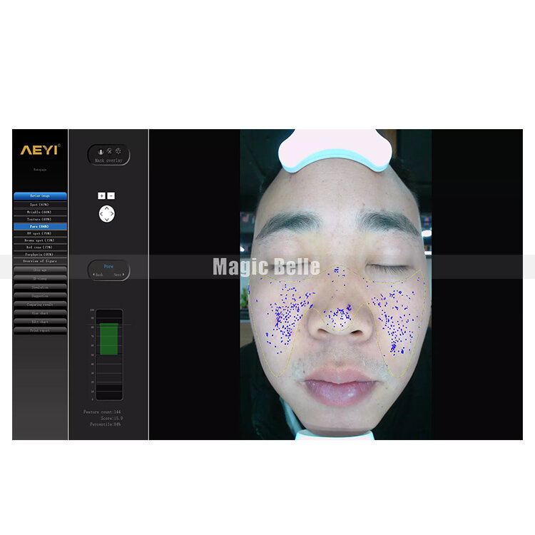 Máquina analizadora de piel Facial, sistema de análisis Facial portátil, máquina de belleza más Popular