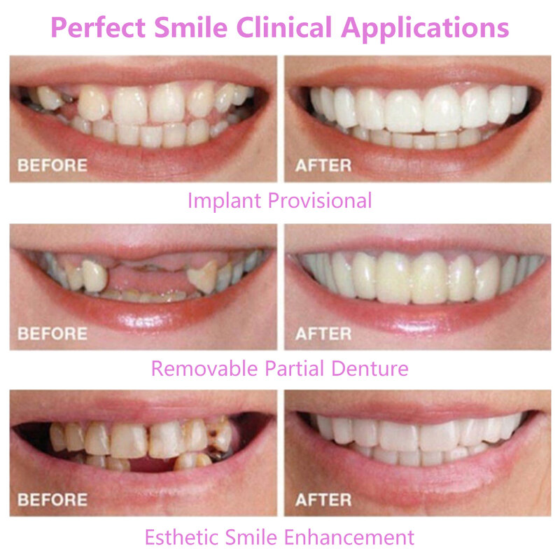 Conjunto completo superior + inferior silicone dentes falsos superior inferior inferior inferior folheados falsos dentes cosméticos dentadura um tamanho se encaixa a maioria