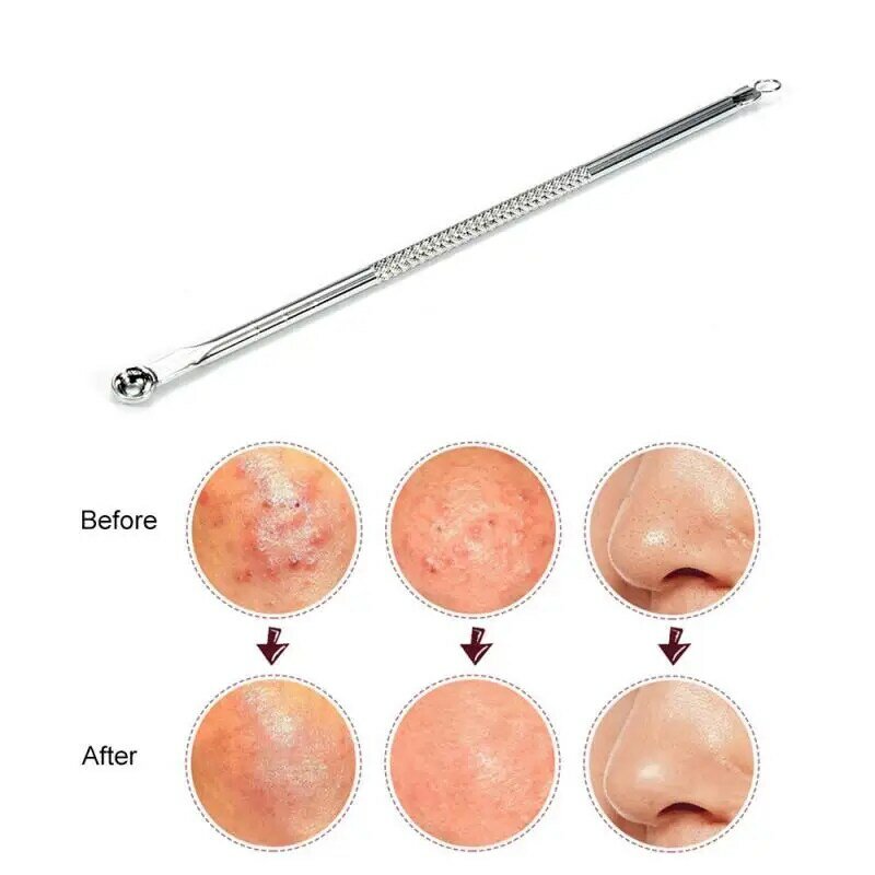 4pcs/Set Acne Removal Needle Stainless Steel Pimple Blackhead Remover Tool Blemish Face Skin Care Beauty Facial Pore Cleaner
