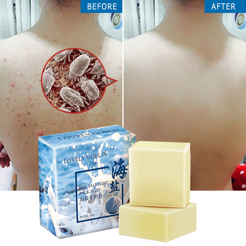 65g Sea Salt Soap Cleaner Removal Pimple Pores Acne Treatment  Moisturizing Face Care Wash Basis Soap Wash Soap Face Care TSLM1