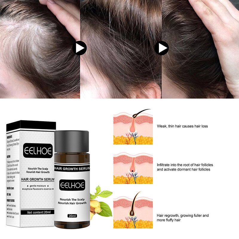 Hair Care Hair Growth Essential Oils Essence 20ml For Men Women Ginger Extract Hair Regeneration Repair Hair Growth Serum