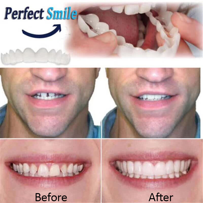 3pc prothese tanden美白ネップtandカバーコンフォートフィットスナップオンシリコンschoonheidフェーシングtanden bovenste cosmetische tanden