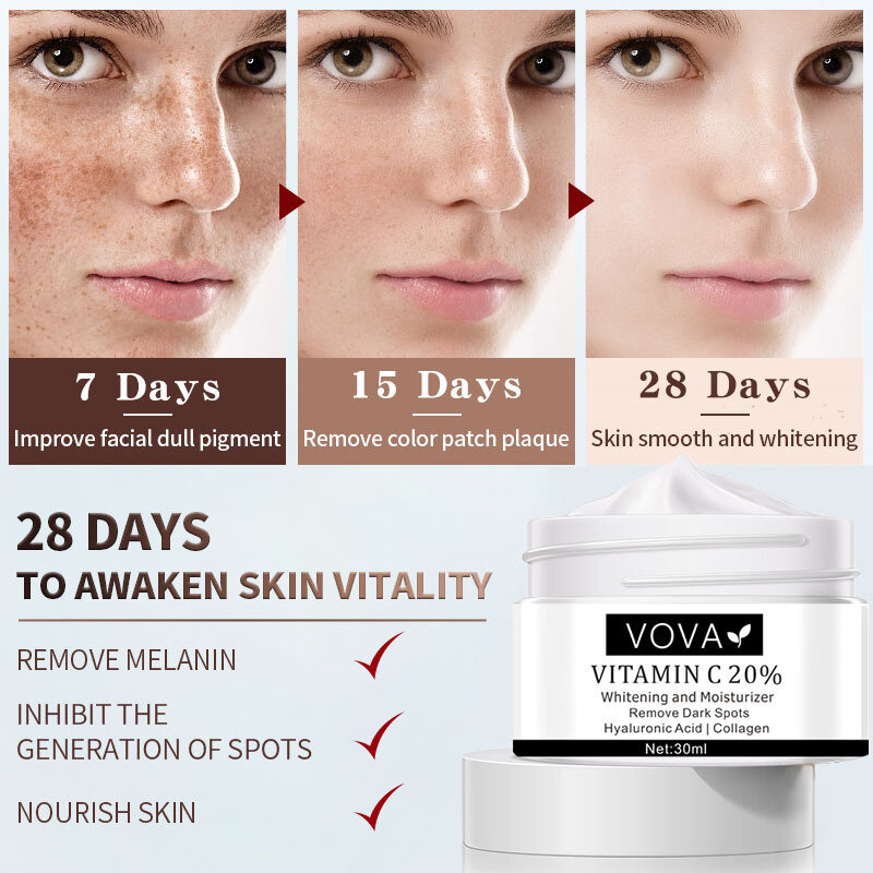 20% Vitamin C Bleaching Creme Erhellen Dunkle Flecken Verblassen Makel Anti-Aging Freckls Akne Narbe Bleichen Melanin Entferner Haut pflege