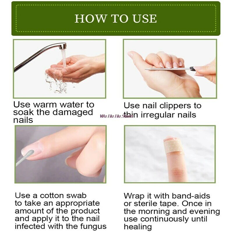 Tratamiento para uñas de hongos, suero antibacteriano para el cuidado de los pies, paroniquia, reparación de hierbas