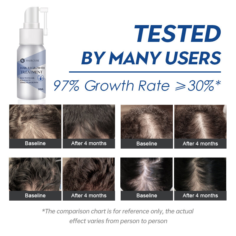 Spray anti perda de cabelo, óleo essencial para crescimento capilar eficaz para homens e mulheres, produtos naturais de recrescimento capilar líquido
