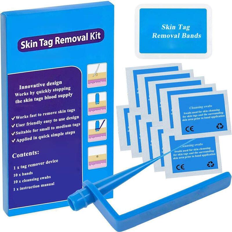 Strumento per verruca talpa per la cura del viso Non tossico Micro Band per Kit di rimozione dell'etichetta della pelle blu da piccola a media con tamponi detergenti per uso domestico adulto