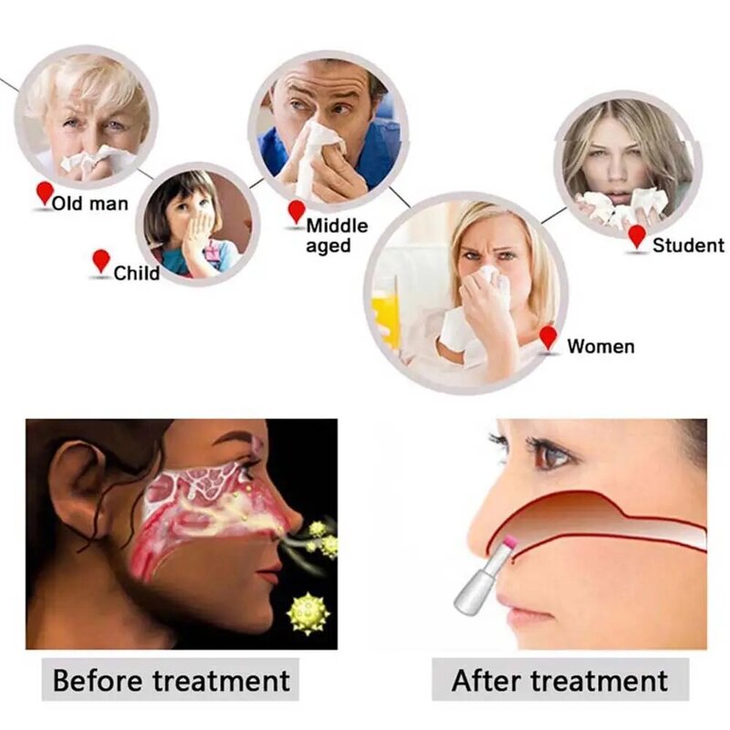 BioNase-terapia de tratamiento para rinitis nasal, masaje nasal, fiebre del heno, protección del comprador, devolución del dinero