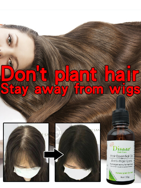 รูขุมขนซ่อมแซม Hair Growth พืช Esential น้ำมัน Fast Anti-Hair Loss Regrowth Serum ผลิตภัณฑ์รักษาบางผมหนังศีรษะ30Ml