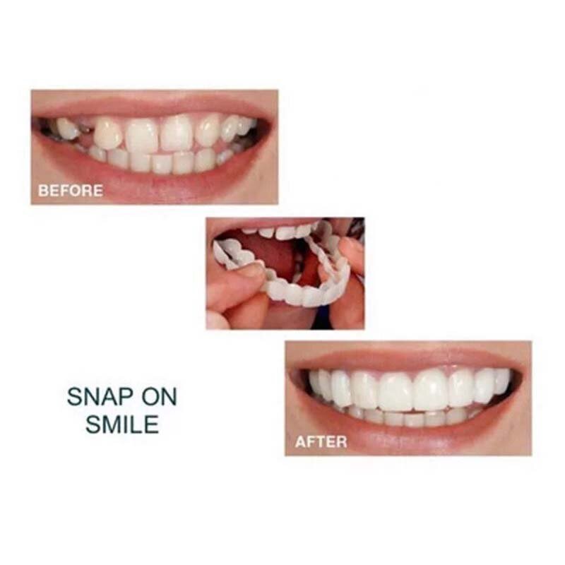 1 paio di denti finti denti inferiori superiori copertura sorriso denti sbiancamento bretelle simulazione protesi plastica ortodontica strumenti di igiene orale