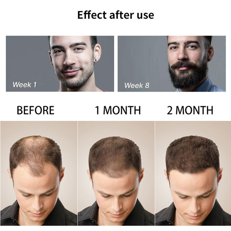 4 pz/set Kit per la crescita della barba Set per la crescita dei capelli da uomo Set per la crescita della barba olio essenziale Set per la cura della barba del viso miglior regalo per gli uomini