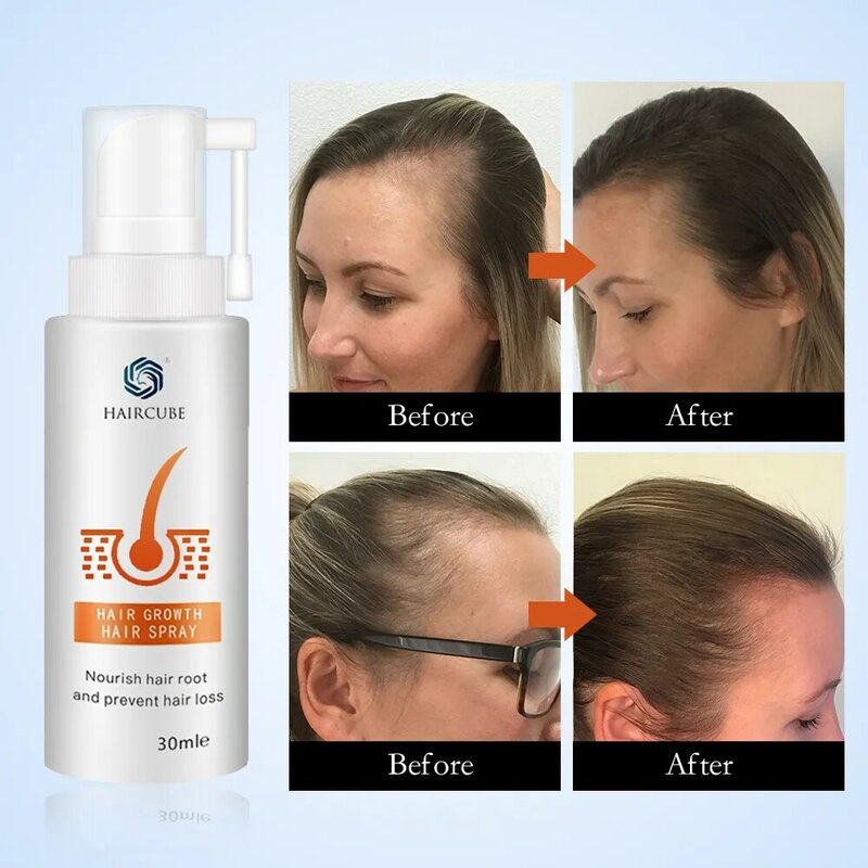 Produto para crescimento capilar, essência para reparação de raíz danificada do cabelo, spray eficaz para homens e mulheres